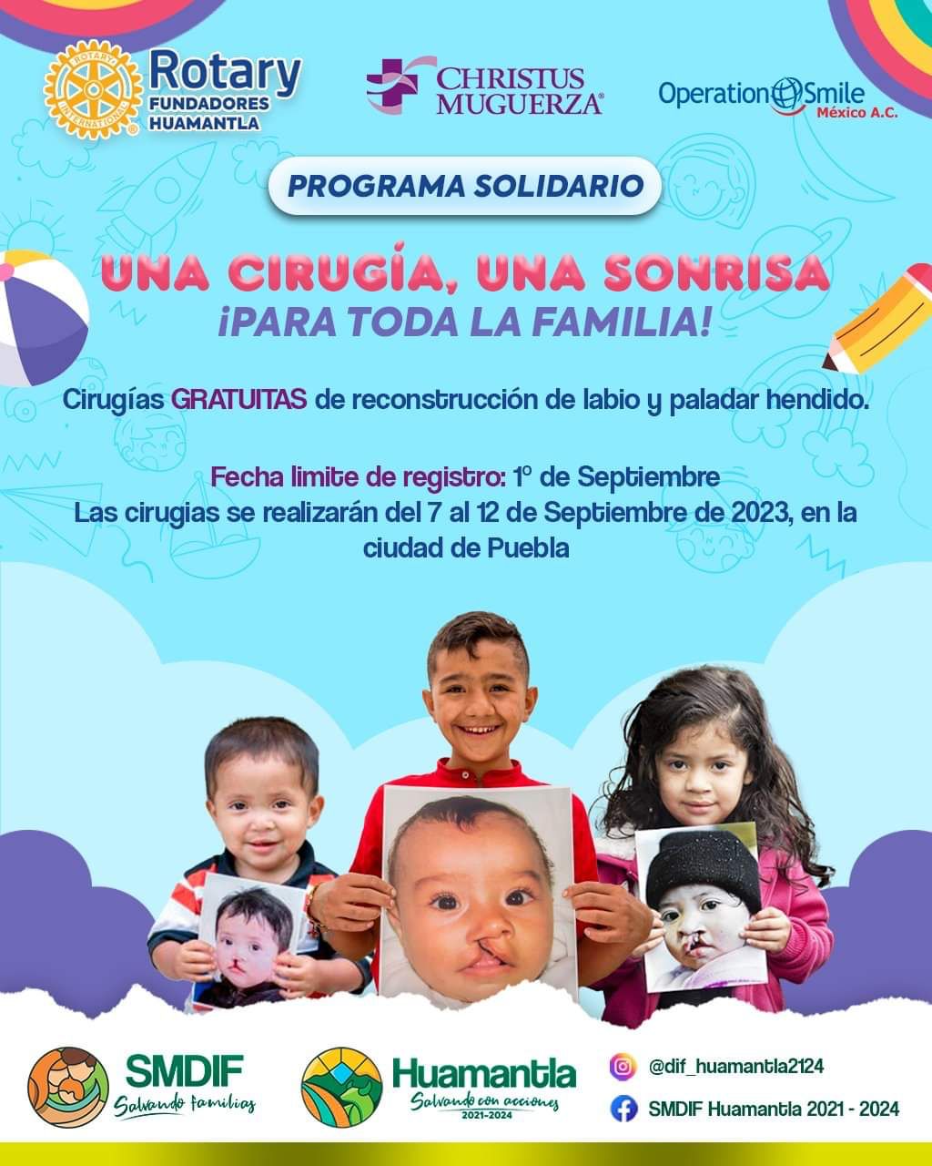 DIF Huamantla, Club Rotary y Operation Smile brindarán cirugías gratuitas de reconstrucción de labio y paladar hendido